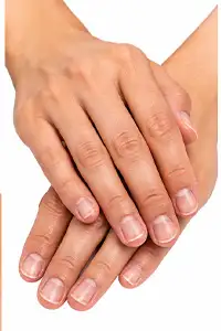 Hand & nail care transformation - Before